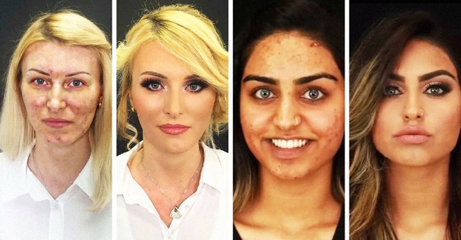 15 transformações que mostram o verdadeiro poder da maquiagem