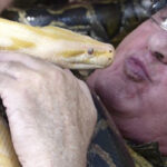 Homem corajoso trata lesão crônica no braço com massagem realizada por cobras