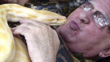 Homem corajoso trata lesão crônica no braço com massagem realizada por cobras