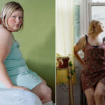 Obesa passa 11 anos fotografando seu corpo para tentar amar a si mesma mas desiste e acaba passando por cirurgia de redução de estômago
