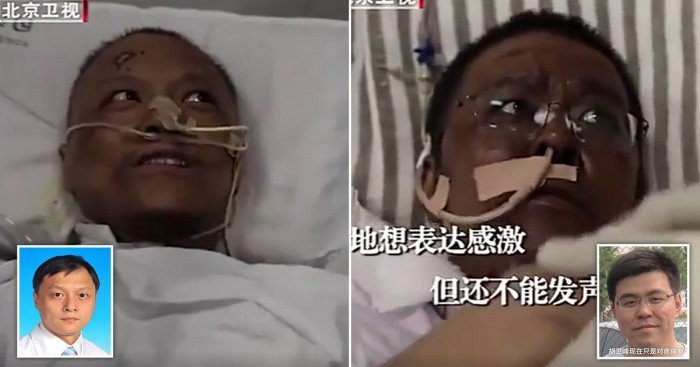 o-curioso-caso-dos-pacientes-chineses-de-covid-19-que-ficaram-com-a-pele-marrom